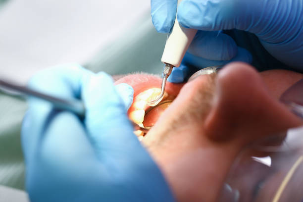 Best Emergency Dentist for Knocked-Out Tooth in Berwyn, PA
