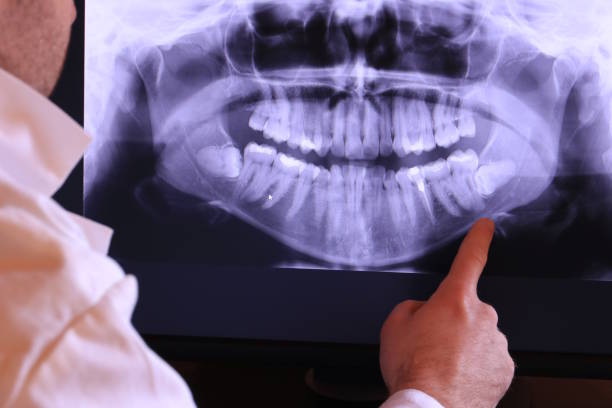 Best Broken or Cracked Tooth Emergency Dentist in Berwyn, PA