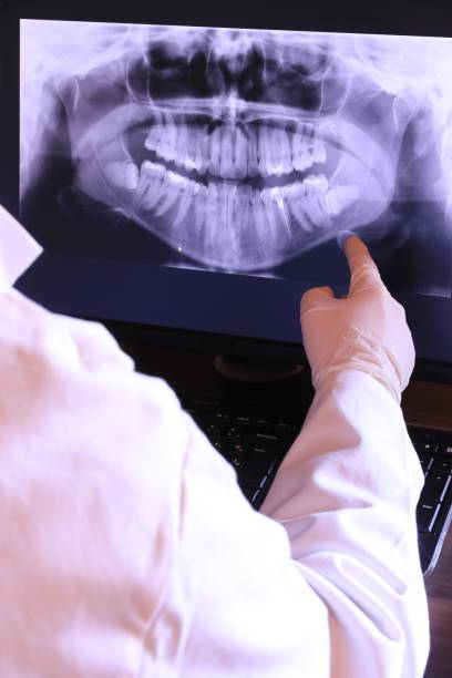 Best Broken or Cracked Tooth Emergency Dentist in Berwyn, PA