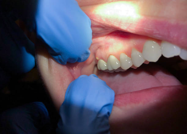Best Weekend Emergency Dentist in Berwyn, PA