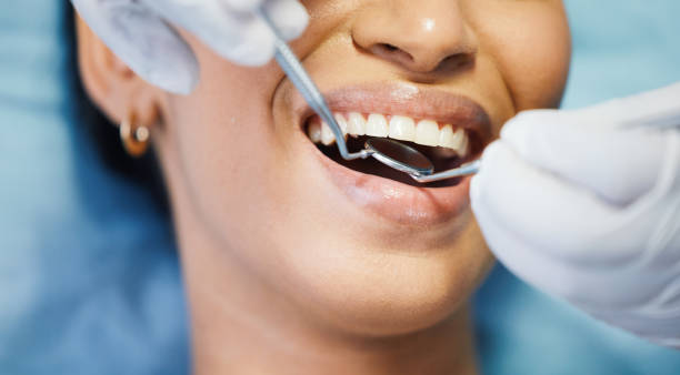 Best Emergency Dentist for Lost Fillings or Crowns in Berwyn, PA